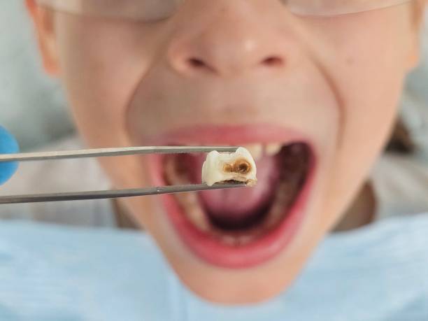 Emergency Dentist Open Today in WV